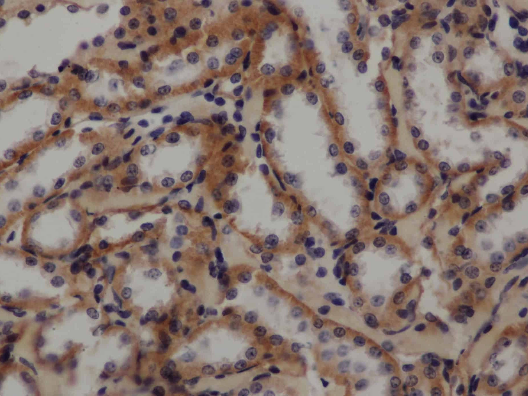 GLUT-1 Polyclonal Antibody Store at -20°C