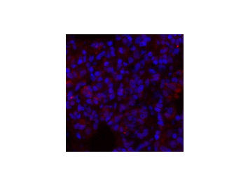 GLUT-1 Polyclonal Antibody Store at -20°C