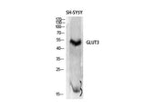 GLUT-3 Polyclonal Antibody Reactivity Human
