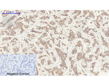 GSK3 beta Polyclonal Antibody Reactivity Human
