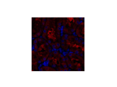 GSK3 beta Polyclonal Antibody Reactivity Human