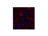 GSK3 beta Polyclonal Antibody Reactivity Human