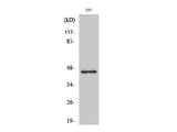 GSK3 beta Polyclonal Antibody Reactivity Human
