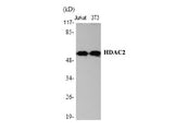 HDAC2 Polyclonal Antibody Reactivity Human