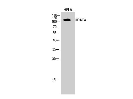 HDAC4 Polyclonal Antibody Store at -20°C