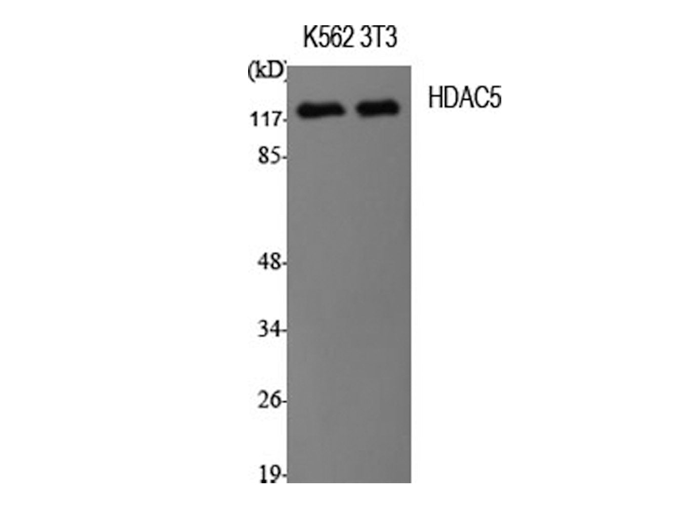 HDAC5 Polyclonal Antibody Store at -20°C