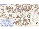 HSP27 Polyclonal Antibody