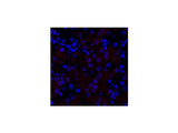 HSP27 Polyclonal Antibody