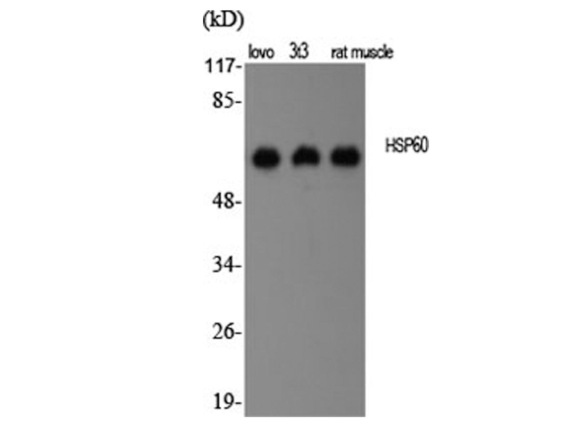 HSP60 Polyclonal Antibody Storage Store at -20°C