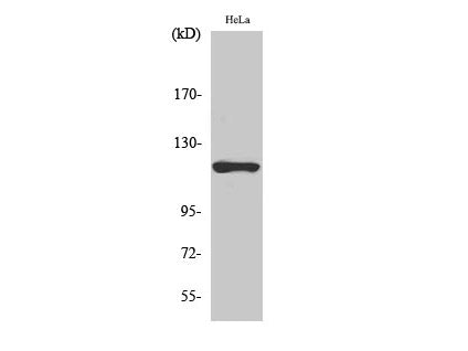 HK1 Polyclonal Antibody Store at -20°C