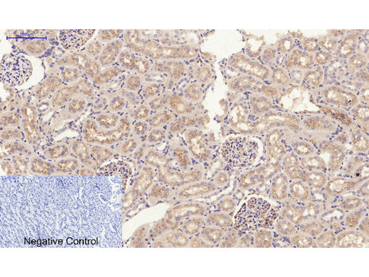 JAK2 Polyclonal Antibody Reactivity Human