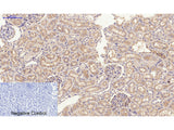 JAK2 Polyclonal Antibody Reactivity Human