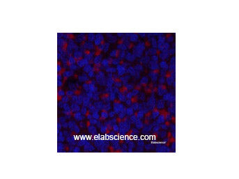 JAK2 Polyclonal Antibody Reactivity Human