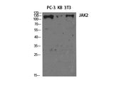 JAK2 Polyclonal Antibody Reactivity Human