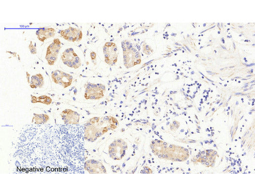 JAK3 Polyclonal Antibody