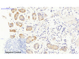 JAK3 Polyclonal Antibody