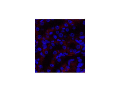 JAK3 Polyclonal Antibody