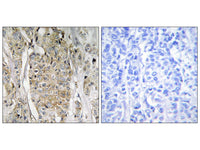 ERBB2 Polyclonal Antibody Storage Store at -20°C