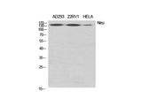 ERBB2 Polyclonal Antibody Storage Store at -20°C