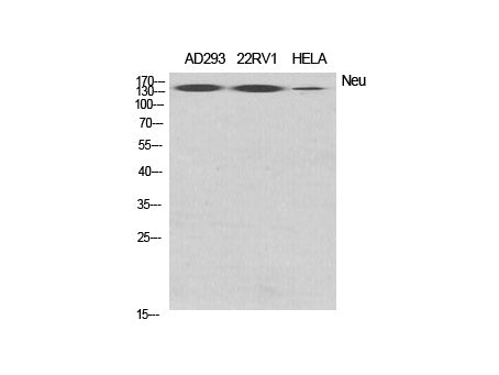 ERBB2 Polyclonal Antibody Storage Store at -20°C