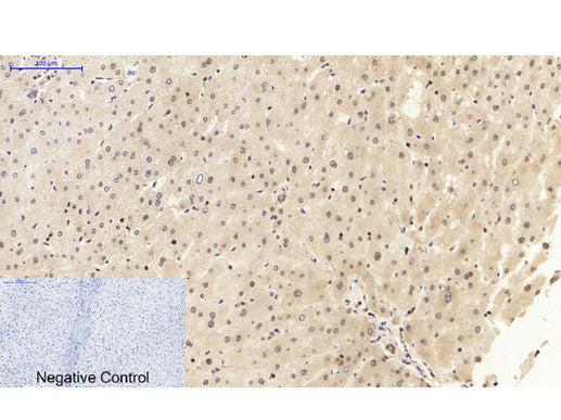 NFκB-p105/p50 Polyclonal Antibody