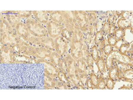 NFκB-p65 Polyclonal Antibody Host Rabbit