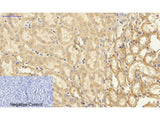 NFκB-p65 Polyclonal Antibody Host Rabbit