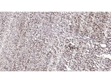 P53 Polyclonal Antibody Storage Store at -20°C