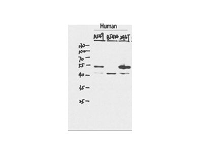 P53 Polyclonal Antibody Storage Store at -20°C
