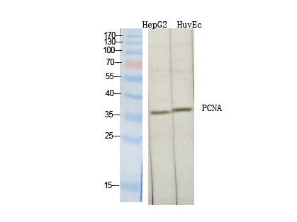 PCNA Polyclonal Antibody Store at -20°C