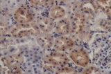 PDGFRB Polyclonal Antibody Reactivity Human
