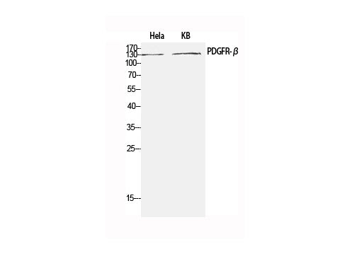 PDGFRB Polyclonal Antibody Reactivity Human
