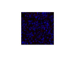 PDPK1 Polyclonal Antibody