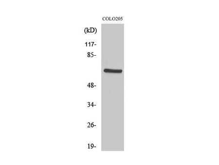 PDPK1 Polyclonal Antibody