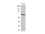 PDPK1 Polyclonal Antibody