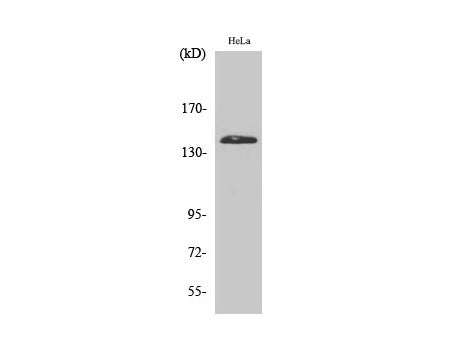 PERK Polyclonal Antibody Host Rabbit