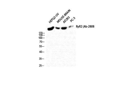 RYR2 Polyclonal Antibody Reactivity Human