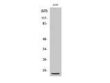 S100A1 Polyclonal Antibody Host Rabbit