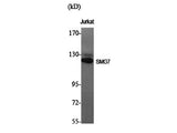 SMG7 Polyclonal Antibody Host Rabbit