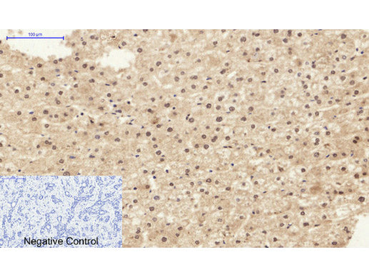 STAT1 Polyclonal Antibody Host Rabbit