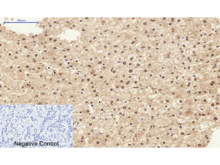 STAT1 Polyclonal Antibody Host Rabbit