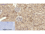 STAT3 Polyclonal Antibody Host Rabbit