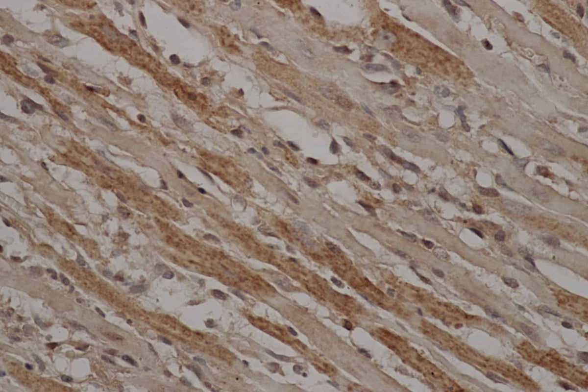 STAT3 Polyclonal Antibody Host Rabbit