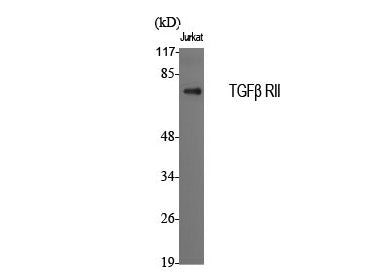 TGF β Receptor II Polyclonal Antibody