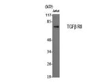 TGF β Receptor II Polyclonal Antibody