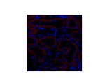 TGF β Receptor II Polyclonal Antibody