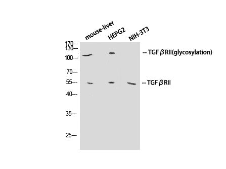 TGF β Receptor II Polyclonal Antibody