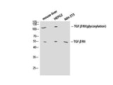 TGF β Receptor II Polyclonal Antibody
