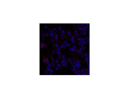 TGFB1 Polyclonal Antibody Host Rabbit