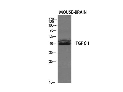 TGFB1 Polyclonal Antibody Host Rabbit